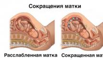 गर्भावस्था के दौरान गर्भाशय की टोन में वृद्धि गर्भावस्था के दौरान स्टेज 1 हाइपरटोनिटी क्या है