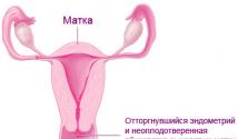 PMS: תסמינים, טיפול, סיבות, הבדל מהריון